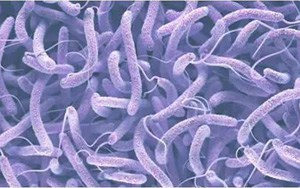 霍亂弧菌免疫檢測相關(guān)產(chǎn)品