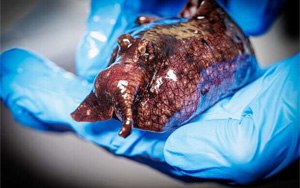 神經信號調節新發現：L-或D-氨基酸？鏡像分子可改變神經元的信號！