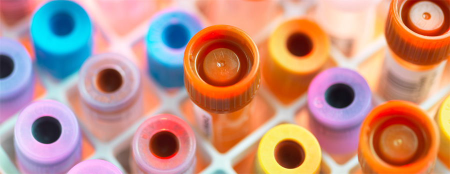 總蛋白檢測(cè)