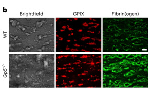 Nature子刊發現全新機制：新的凝血調節機制