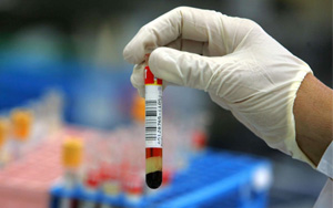 亮氨酰氨基肽酶（LAP）檢測試劑盒用原輔料