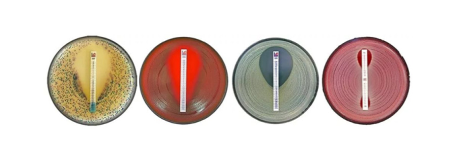 藥敏檢測 藥敏檢測