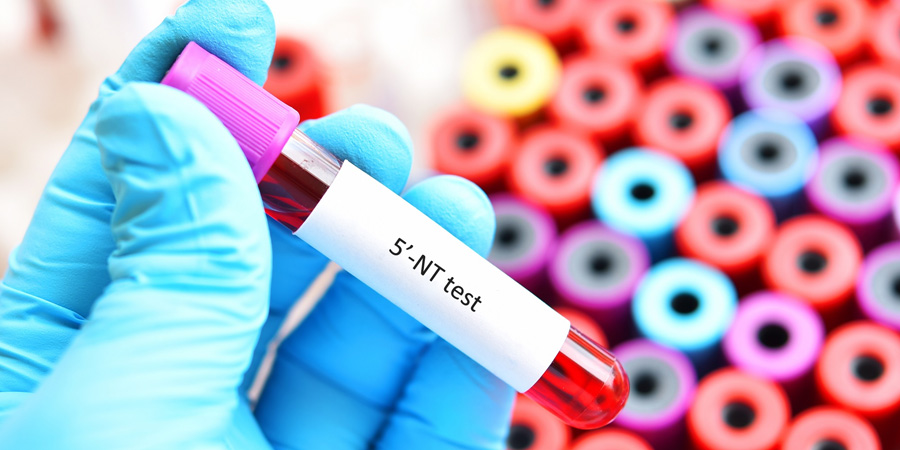 5'-核糖核苷酸磷酸水解酶檢測