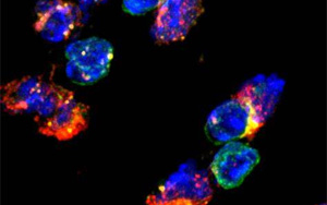 《Nature Immunology》兩種不同類型的免疫細胞幫助20億人控制結核病