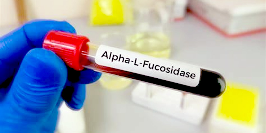 前蛋白檢測 前蛋白檢測