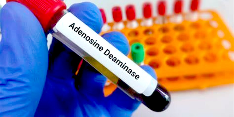 前蛋白檢測 前蛋白檢測