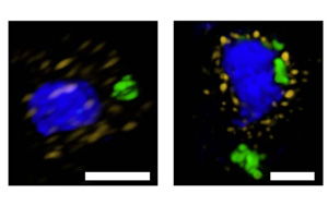 Nature子刊改變游戲規則：一種以前未知的細胞途徑