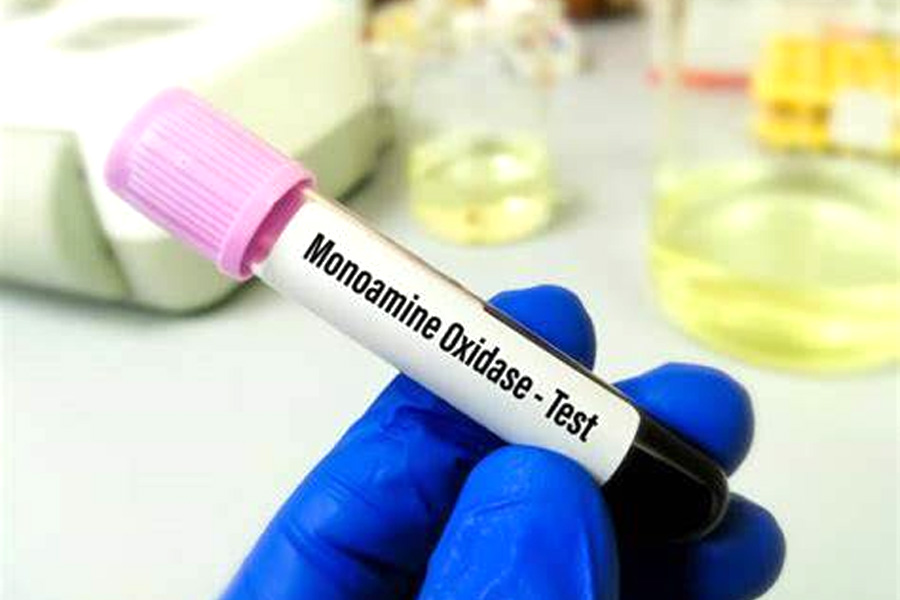 單胺氧化酶(MAO)檢測 單胺氧化酶(MAO)檢測