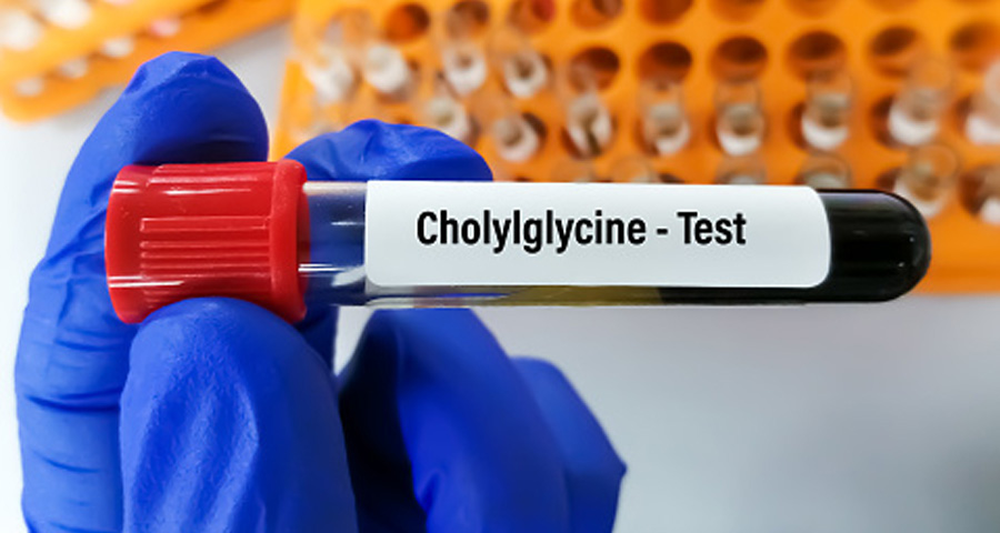 總膽汁酸（TBA）檢測