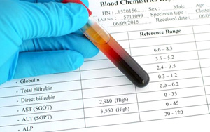 谷丙轉氨酶（ALT）檢測試劑盒用原輔料