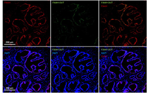 一種罕見基因突變，感覺不到疼痛！新研究揭示其獨特的分子機制