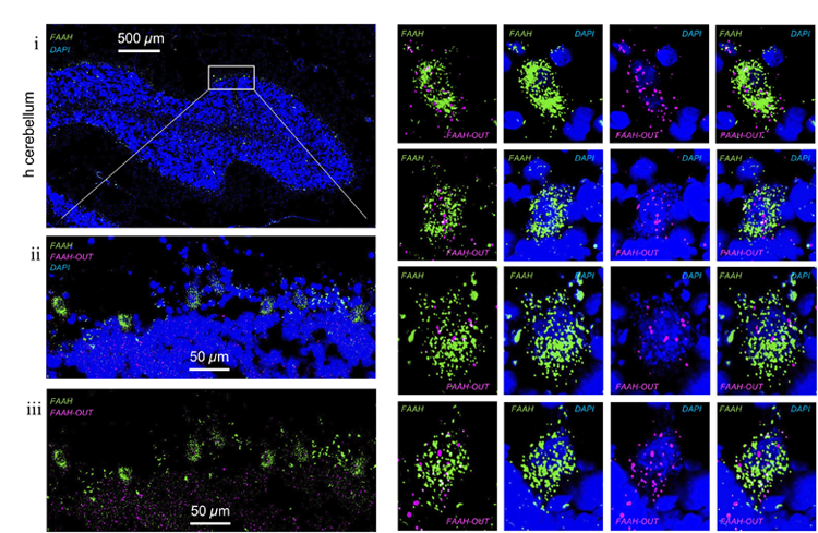 FAAH和FAAH-OUT RNA在人腦組織細胞中的表達水平和定位