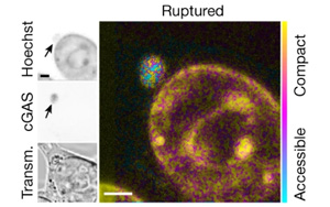Nature發現染色體不穩定性和表觀遺傳改變之間意想不到的聯系