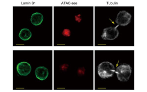 是什么決定了CD8+ T細胞的命運？Immunity新研究指向cBAF復合物