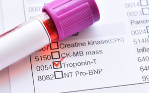 心肌肌鈣蛋白T（cTnT）-磁微粒化學發光法（吖啶酯） /熒光免疫層析解決方案
