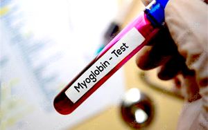 肌紅蛋白（Myo）-磁微粒化學發光（AE/AP） /熒光免疫層析解決方案