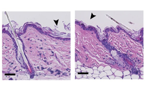 在皮膚老化中起關鍵作用的蛋白質