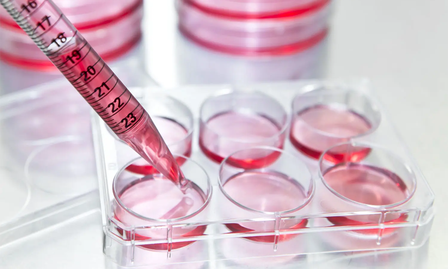 細胞培養 細胞培養