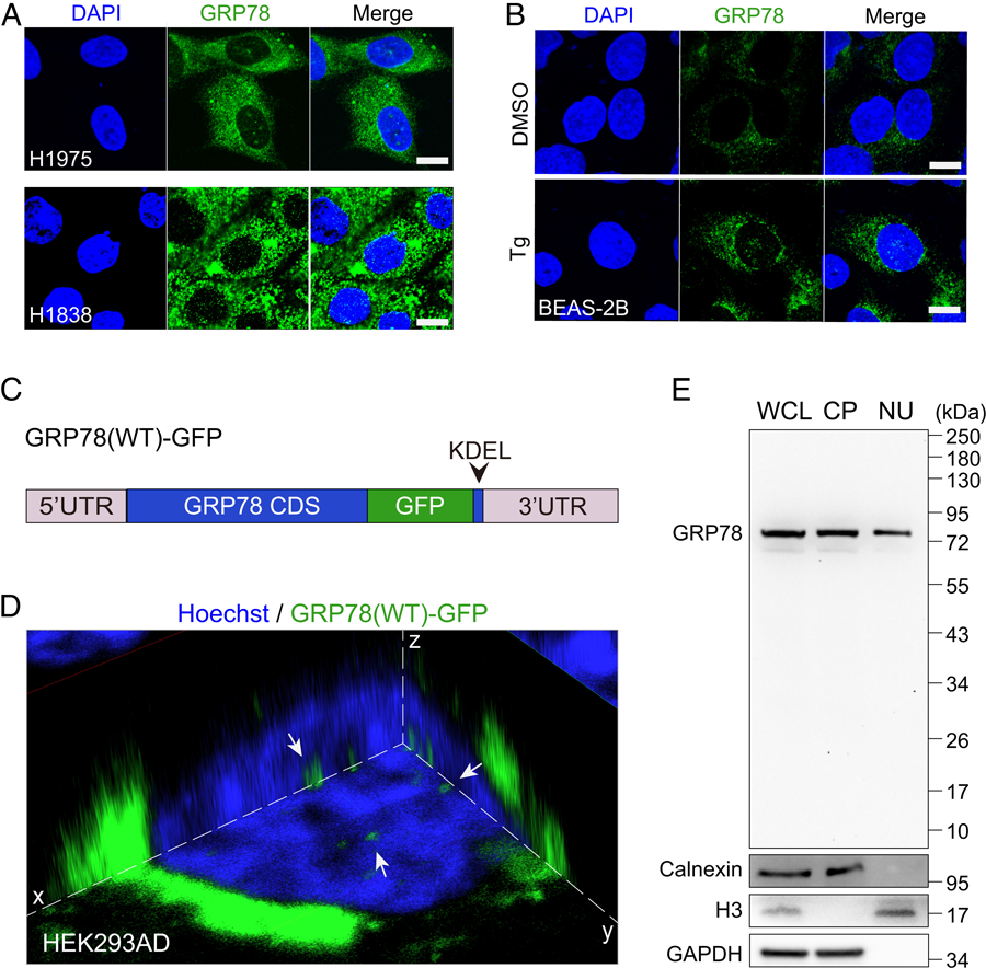 GRP78定位于人癌癥細胞和內質網應激細胞的細胞核。 GRP78定位于人癌癥細胞和內質網應激細胞的細胞核。