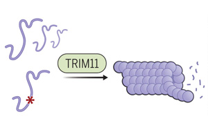 Science：第一次確定了監督tau功能的基因