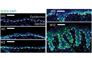 Nature子刊新研究為癌癥如何破壞干細胞精心調整的表觀過程提供了新見解