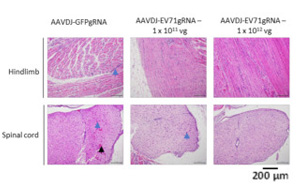 新加坡科學(xué)家開發(fā)基因編輯技術(shù)，消除EV-A71 RNA病毒