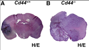肺癌腦轉移的新機制
