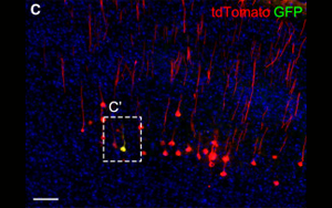 《Neuron》科學家發現腦力更新的生物標志物