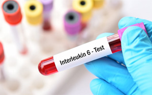 白介素-6（IL-6）-磁微?；瘜W發光（吖啶酯） /熒光免疫層析解決方案