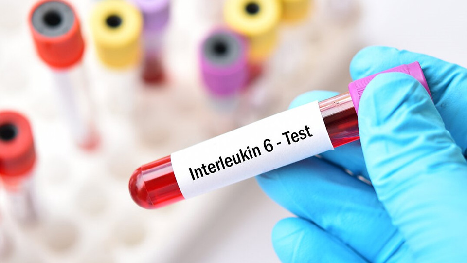 IL-6磁微粒化學發光熒光免疫層析