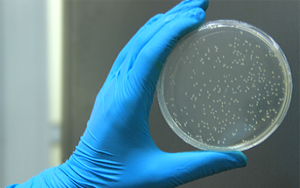 去除融合蛋白標簽的選項TEV蛋白酶——看這里