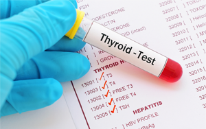 促甲狀腺素（TSH）-磁微?；瘜W發光法（吖啶酯） /熒光免疫層析解決方案