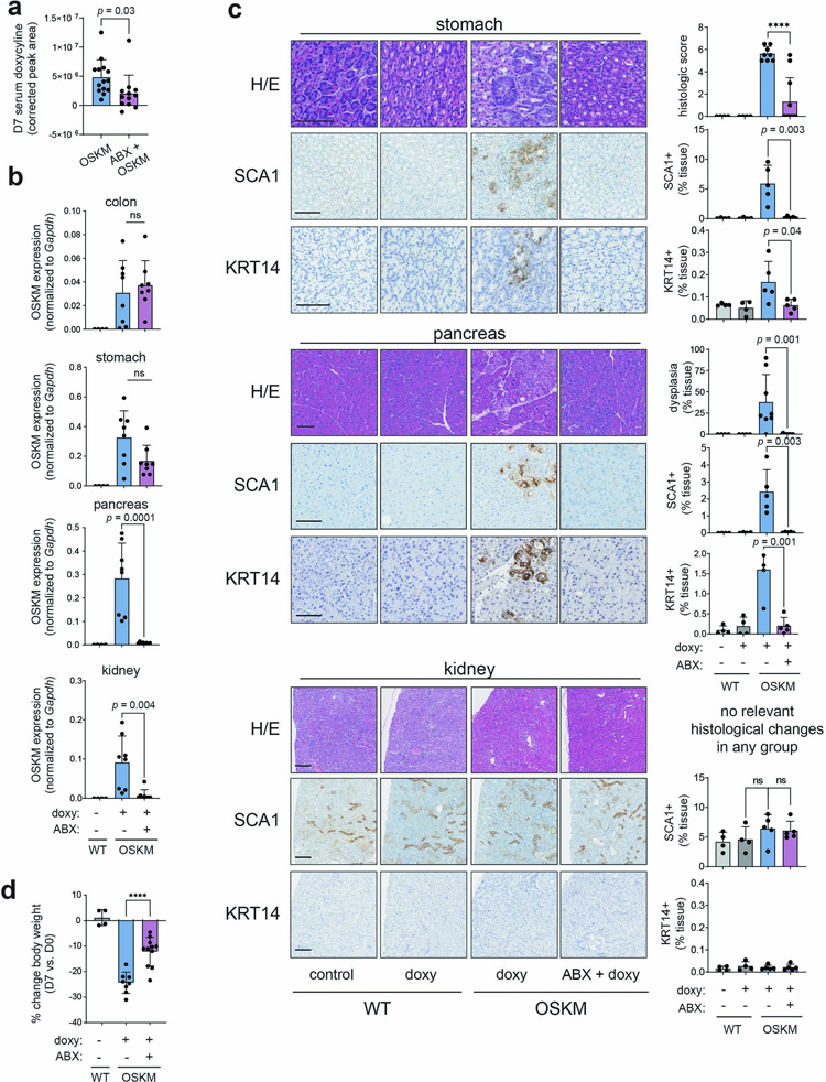 廣譜抗生素治療抑制體內重編程