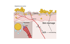 Cell：首次證明一種常見的皮膚細菌可以通過直接作用于神經細胞而引起瘙癢