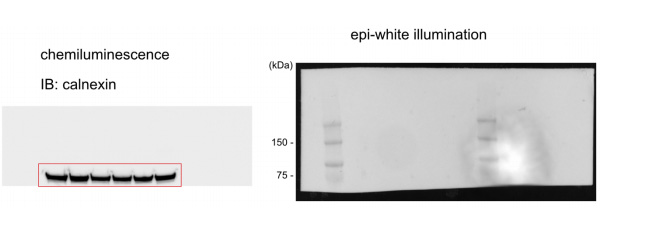 Calnexin水平作為載量控制如圖所示
