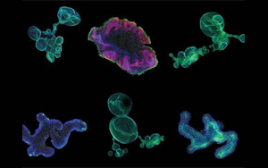 再生醫學的未來，到類器官的世界中去