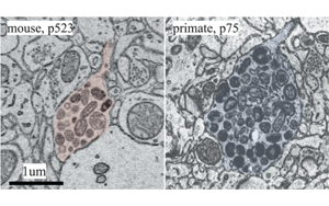 大腦什么時候長大?新發現震驚神經科學家