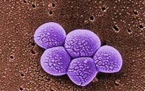 《Science》突破性新抗生素，遏制耐藥細(xì)菌