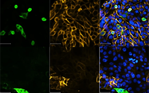 Nature最新研究表明，一類新的抗病毒藥物可以對抗SARS-CoV-2