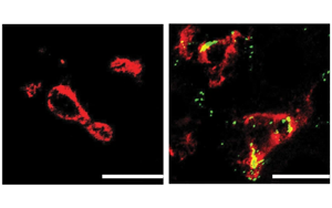 Nature子刊：肝臟中的免疫細胞會對高膽固醇水平做出反應，并吃掉多余的膽固醇