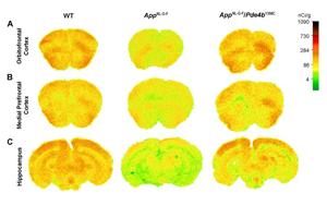 發(fā)現(xiàn)阿爾茨海默病的新治療靶點PDE4B 活性降低27%可大大挽救AD小鼠記憶、大腦功能和炎癥