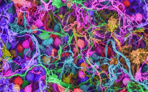 Nature：要想形成長期記憶，必須有DNA損傷和腦部炎癥？！