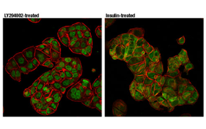 Nature最新發現控制CAR-T細胞壽命的蛋白質！