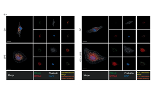 《Nature》第一次揭開糖皮質激素如何激活人體對炎癥的自然“剎車”