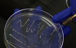 《Nature》科學家揭開了一種致命霍亂病菌背后的神秘面紗