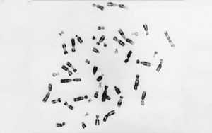 Nature：未知的補(bǔ)償機(jī)制——細(xì)胞如何處理額外的染色體