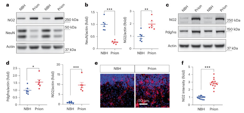 朊病毒疾病模型中NG2膠質細胞的激活 朊病毒疾病模型中NG2膠質細胞的激活