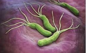 幽門(mén)螺桿菌(HP.CagA)-磁微粒化學(xué)發(fā)光法（AE/AP）解決方案